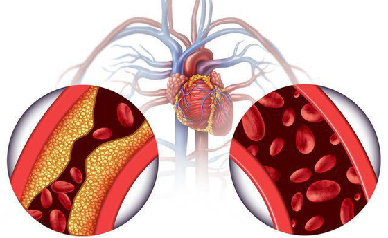 Dihydromyricetin dell'etichetta privata dell'OEM dalla polvere 98% di dihydromyricetin dell'estratto del tè della vite del tè della vite